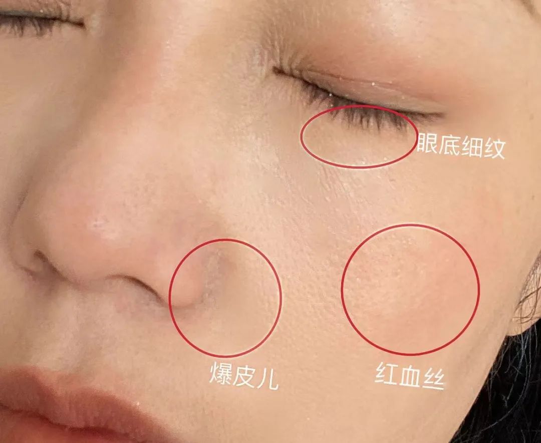 如何判斷自己是不是干敏肌膚？干敏肌有哪些特征？