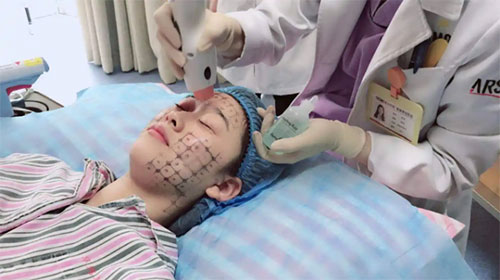 熱瑪吉有什么效果和副作用？