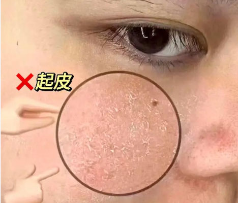 化完妝后臉上起皮怎么補(bǔ)救？